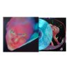 Fontaines D.C. "Dopamine Chambers" vinile blu indie exclusive